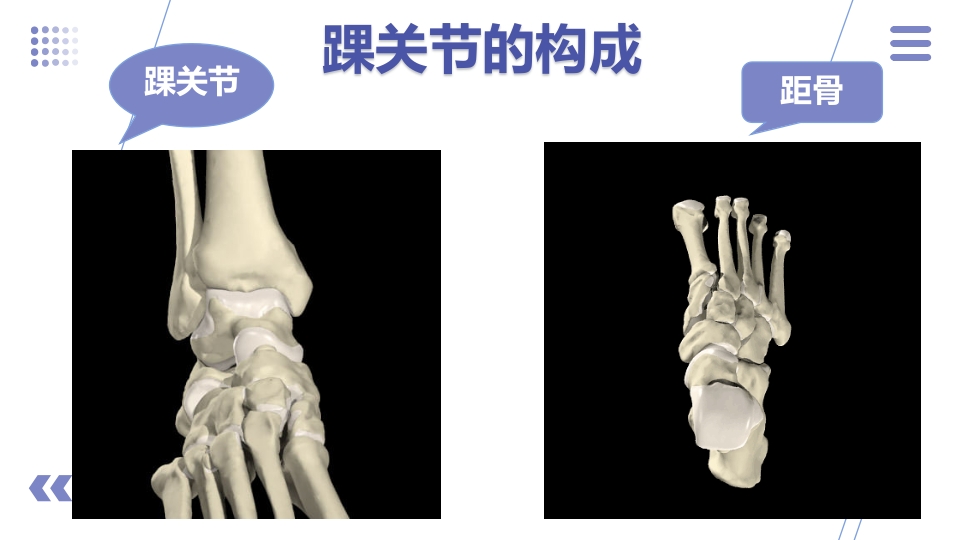 1例左三踝骨折患者的护理查房PPT课件4