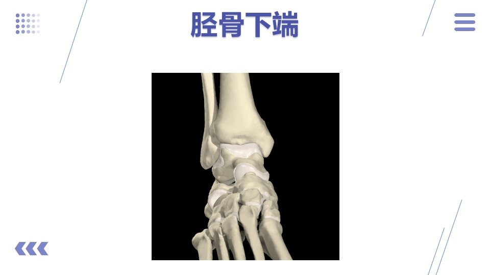 1例左三踝骨折患者的护理查房PPT课件5