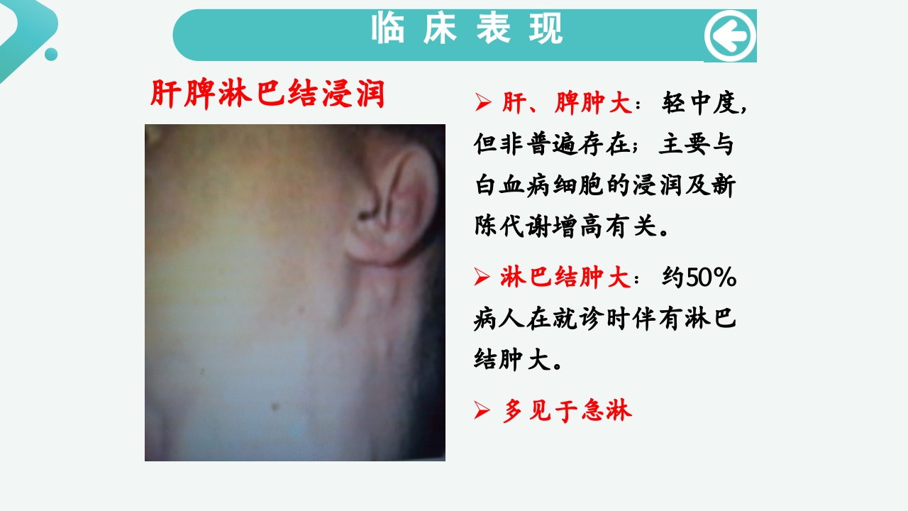 白血病病人的护理PPT课件18