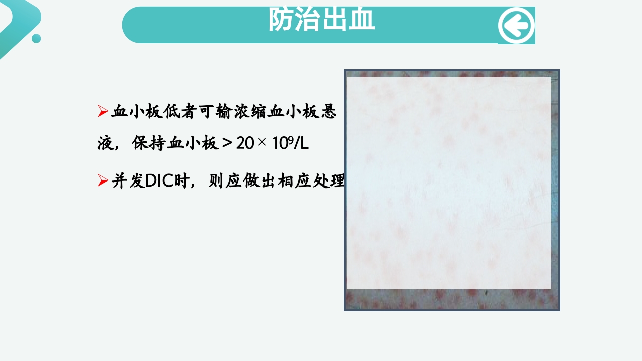 白血病病人的护理PPT课件32