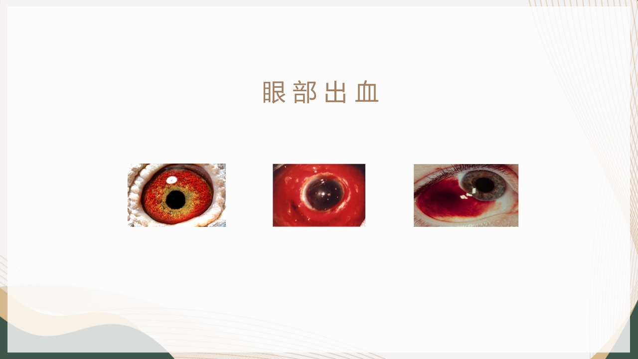 血液透析并发症-眼部出血的护理查房PPT课件10