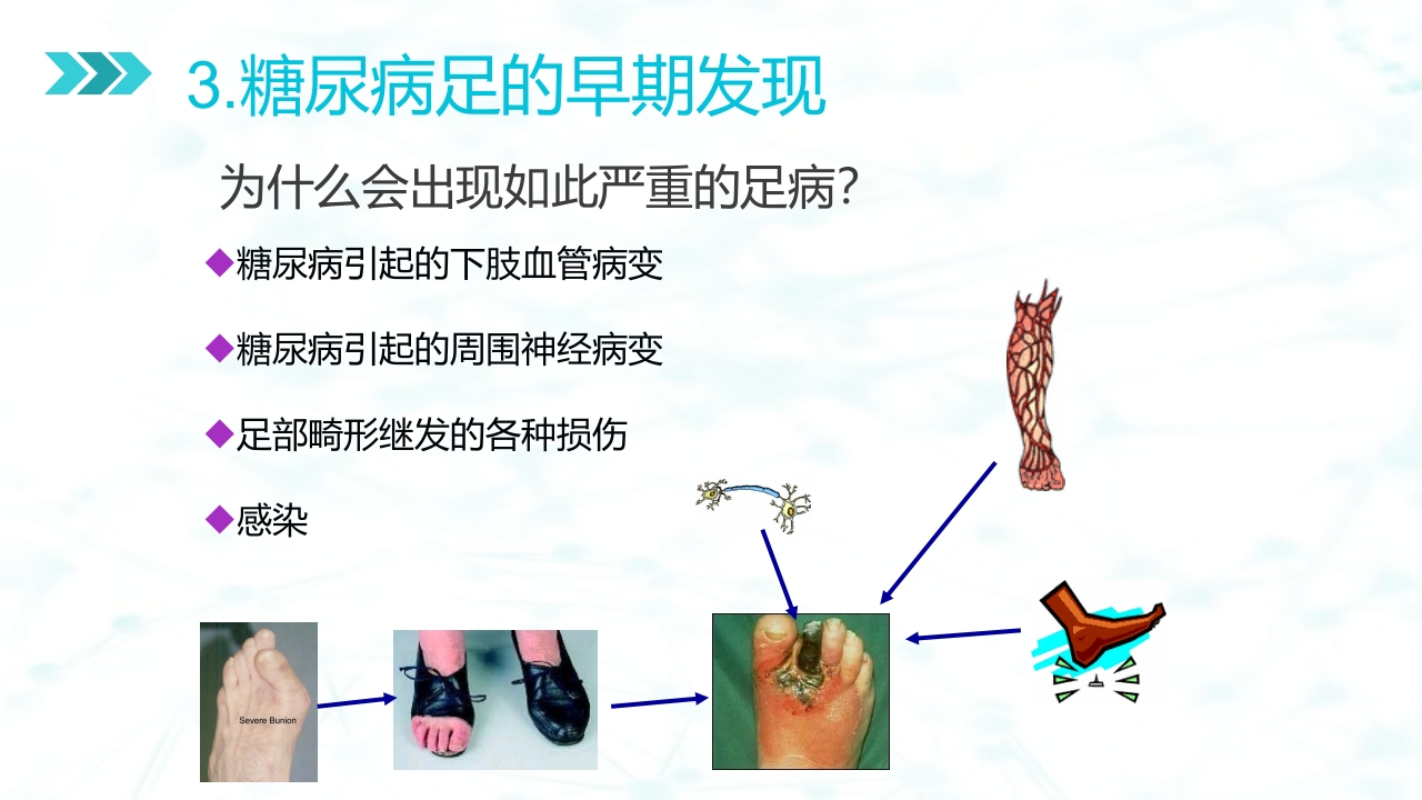 糖尿病足病的健康教育与病人管理PPT课件12