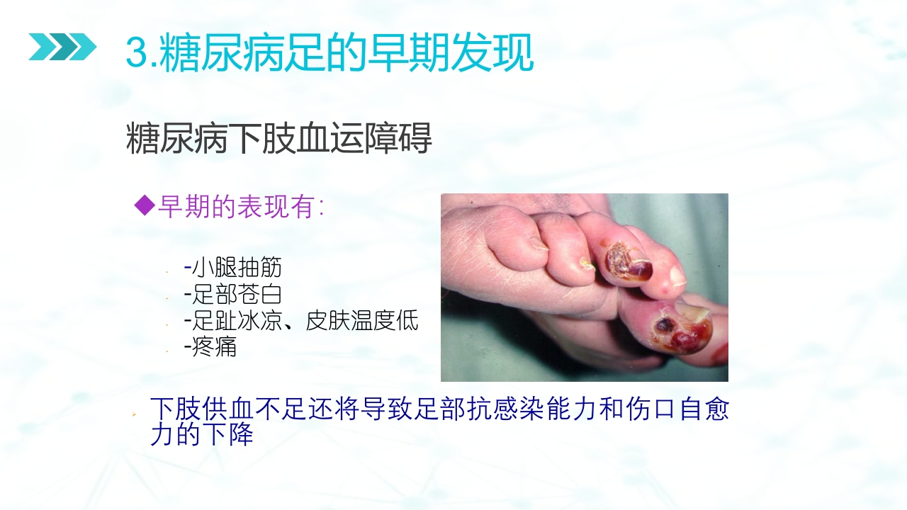 糖尿病足病的健康教育与病人管理PPT课件13