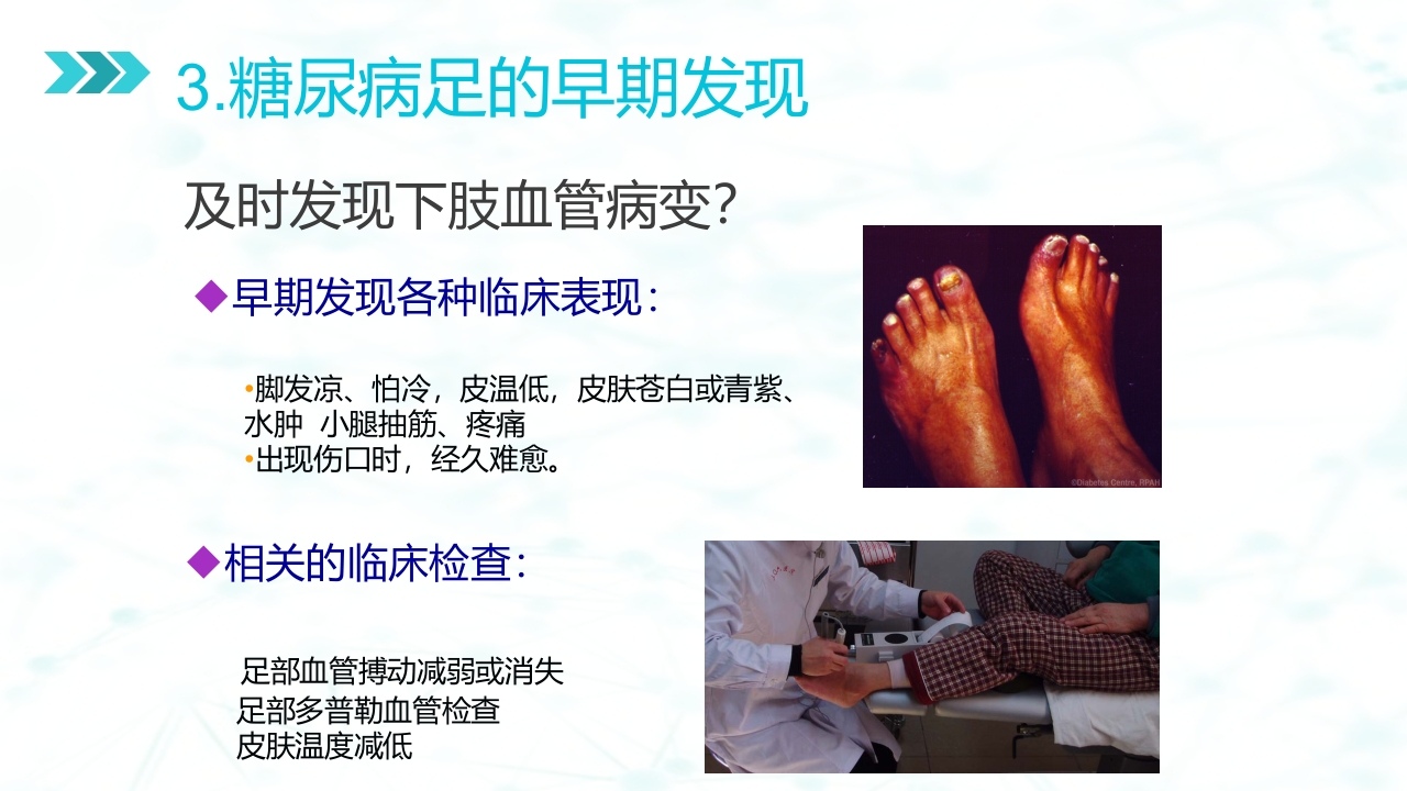 糖尿病足病的健康教育与病人管理PPT课件14