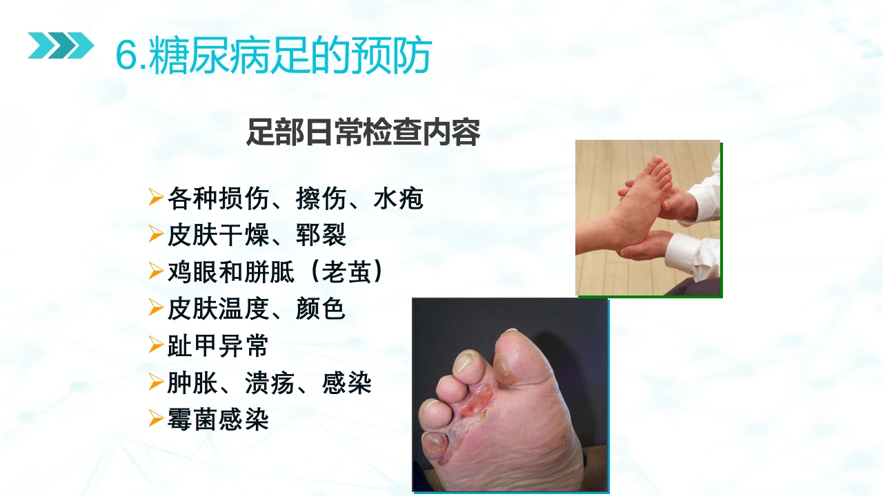 糖尿病足病的健康教育与病人管理PPT课件30