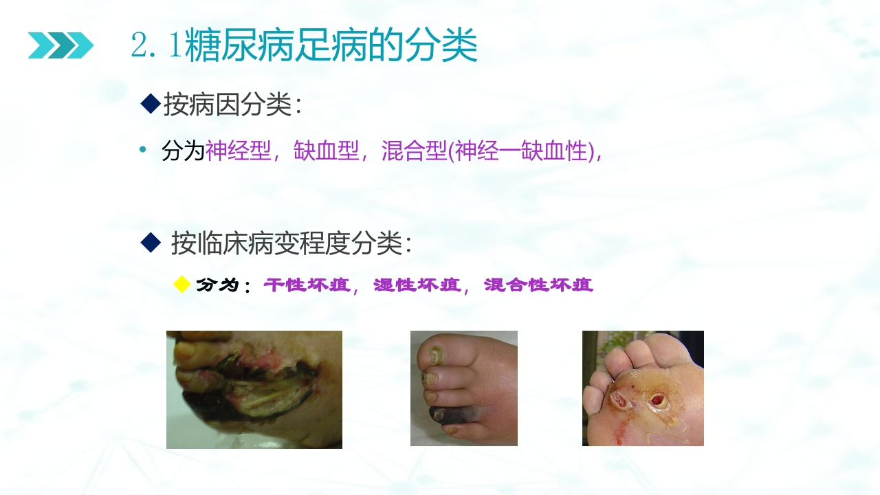 糖尿病足病的健康教育与病人管理PPT课件8