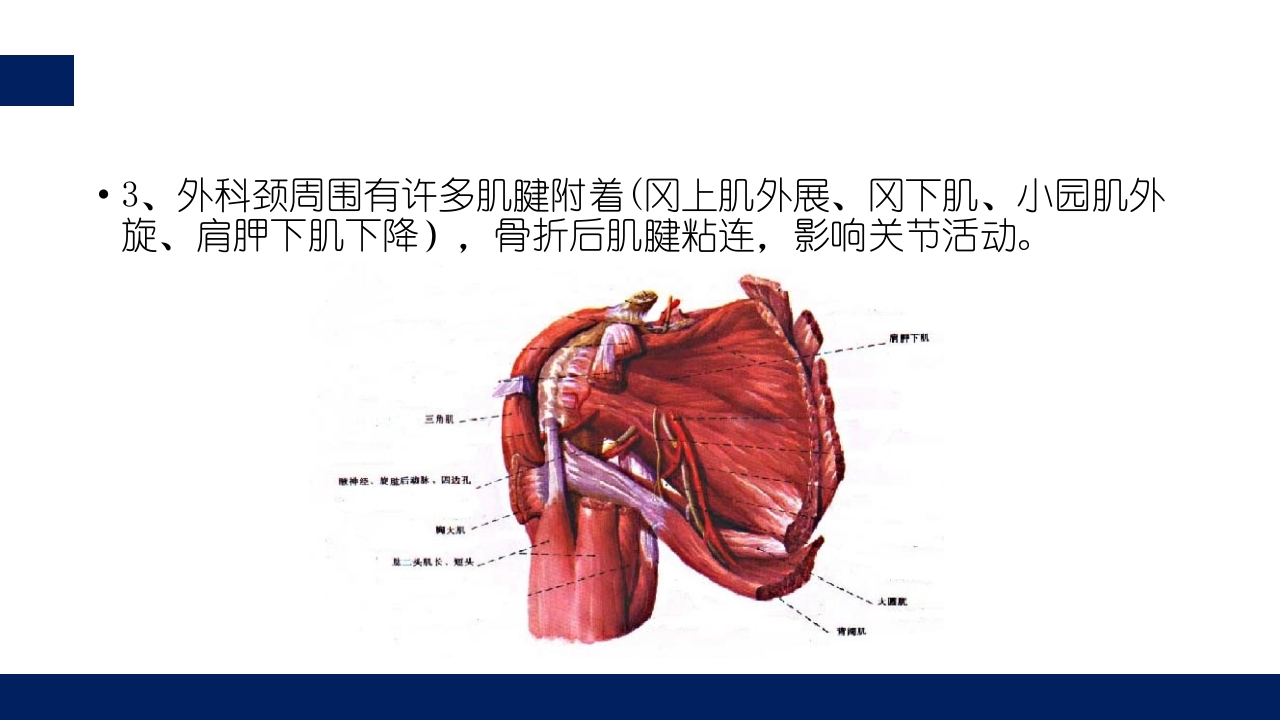 肱骨外科颈骨折PPT课件15