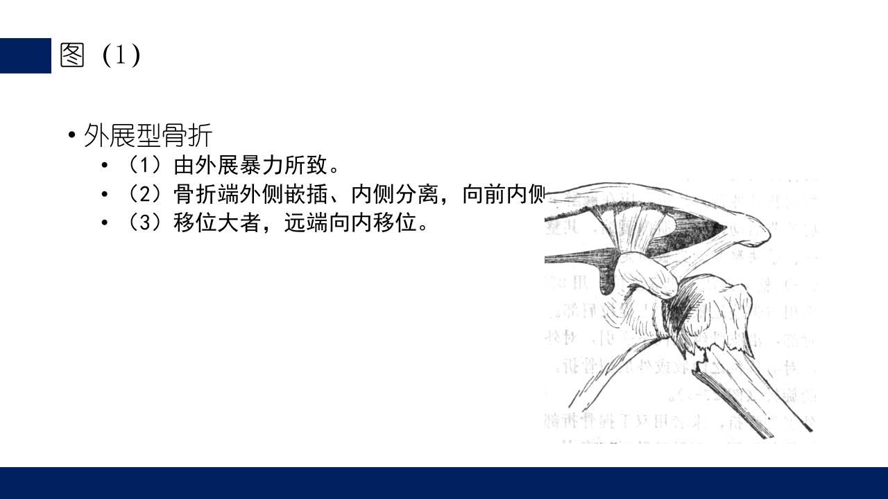 肱骨外科颈骨折PPT课件18