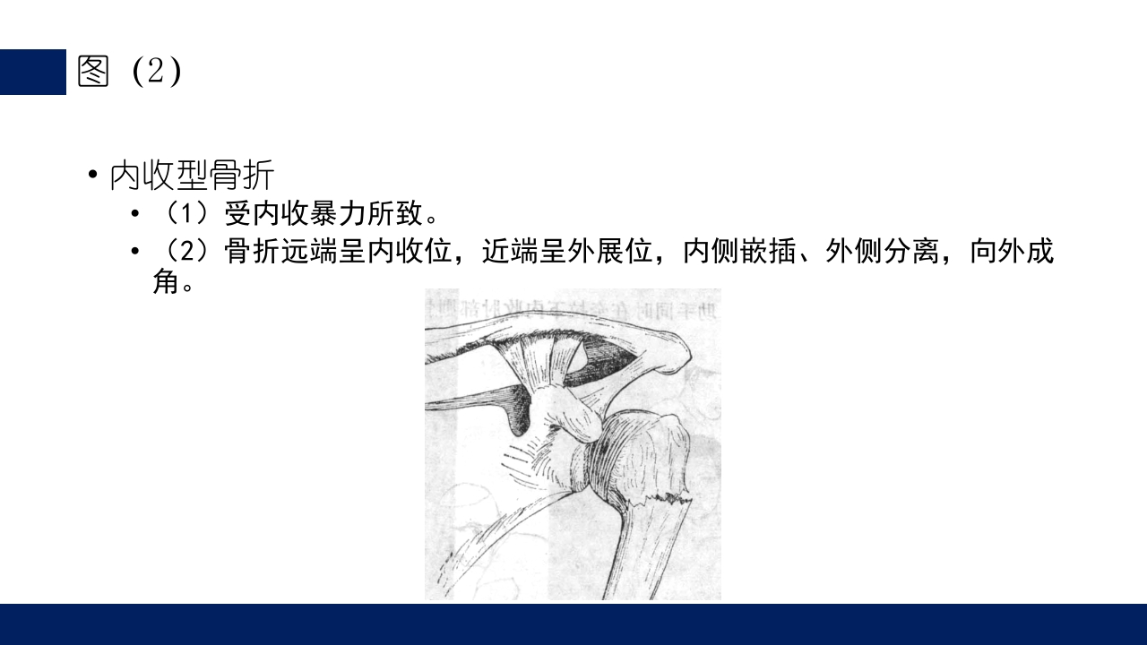 肱骨外科颈骨折PPT课件20
