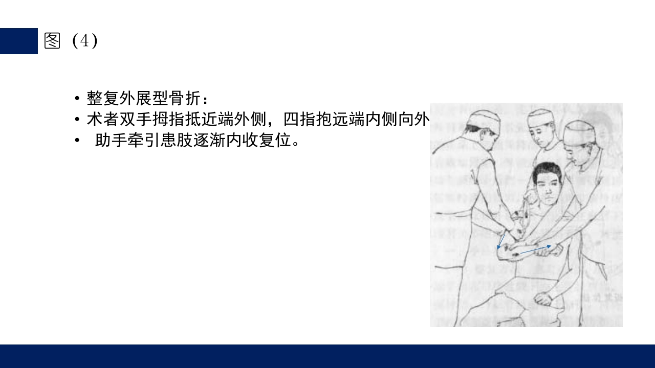 肱骨外科颈骨折PPT课件36