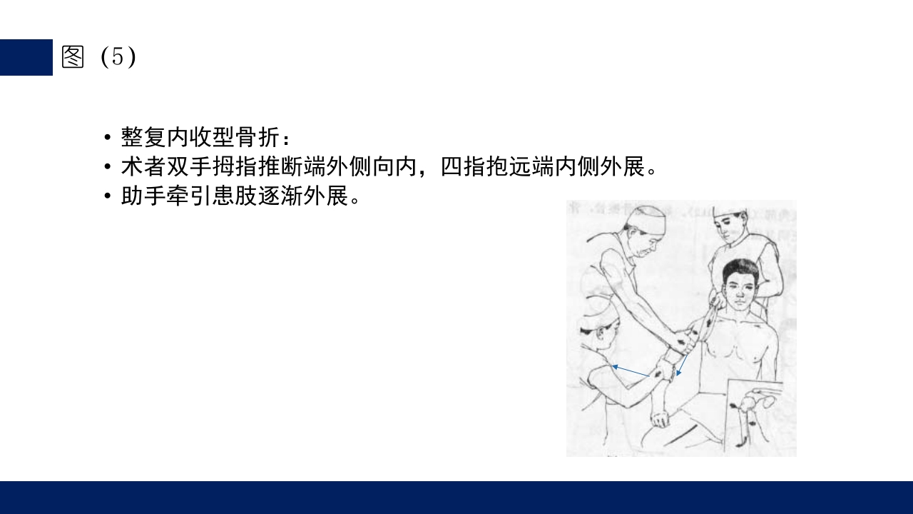 肱骨外科颈骨折PPT课件37