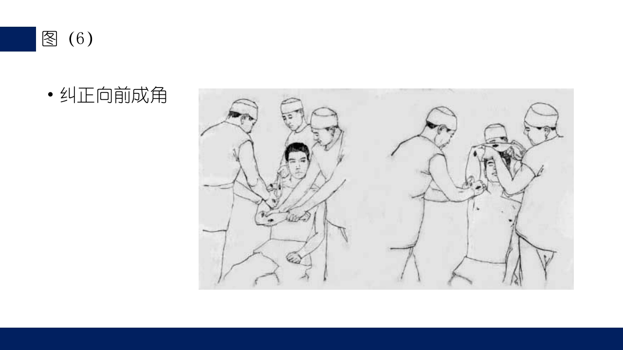 肱骨外科颈骨折PPT课件39