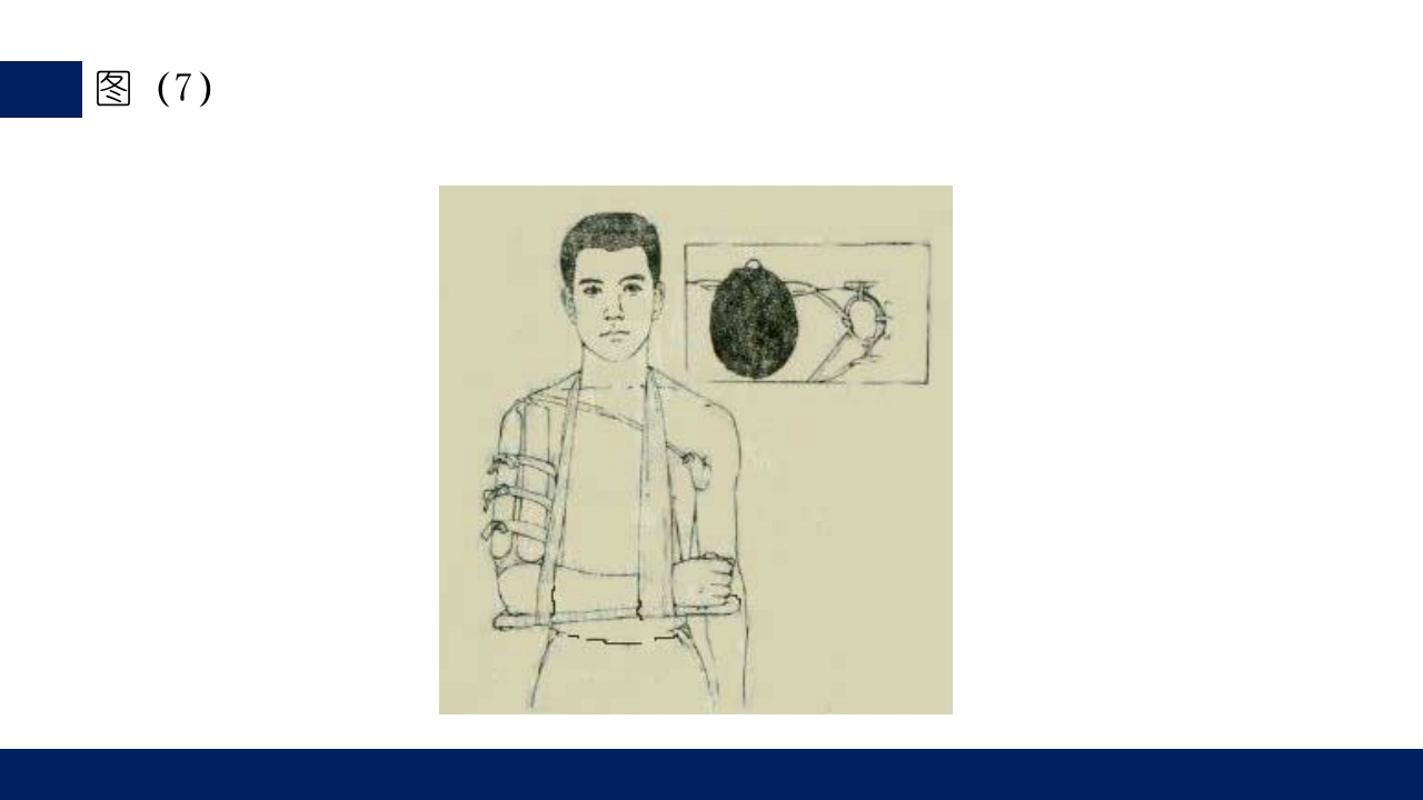 肱骨外科颈骨折PPT课件40