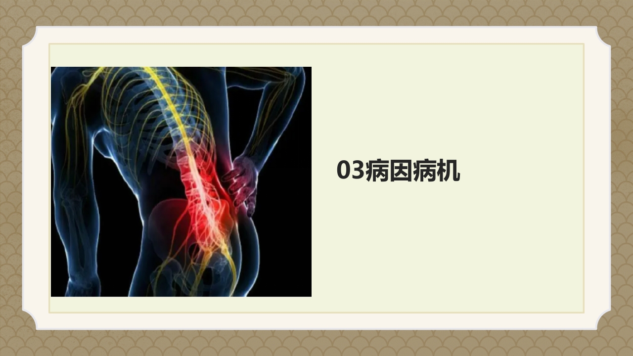 腰椎间盘突出症中医辨证论治ppt课件10