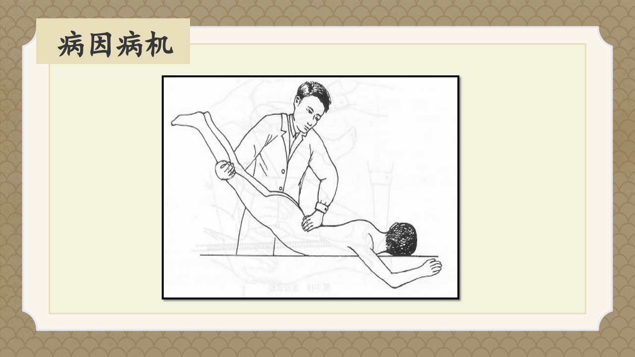 腰椎间盘突出症中医辨证论治ppt课件22