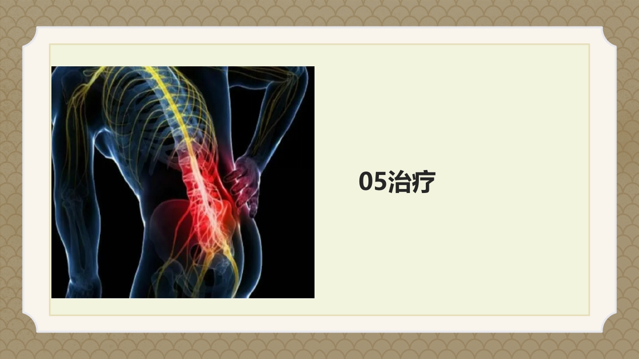 腰椎间盘突出症中医辨证论治ppt课件26