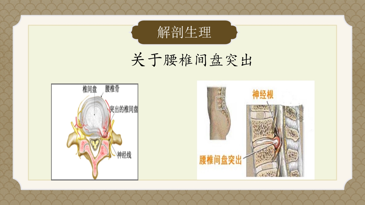 腰椎间盘突出症中医辨证论治ppt课件8