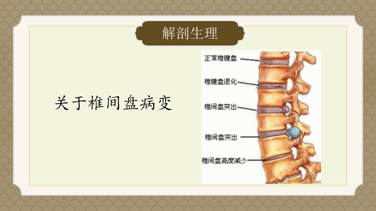 腰椎间盘突出症中医辨证论治ppt课件9