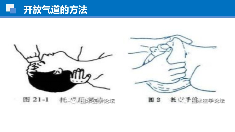 简易呼吸球囊的临床应用ppt课件37