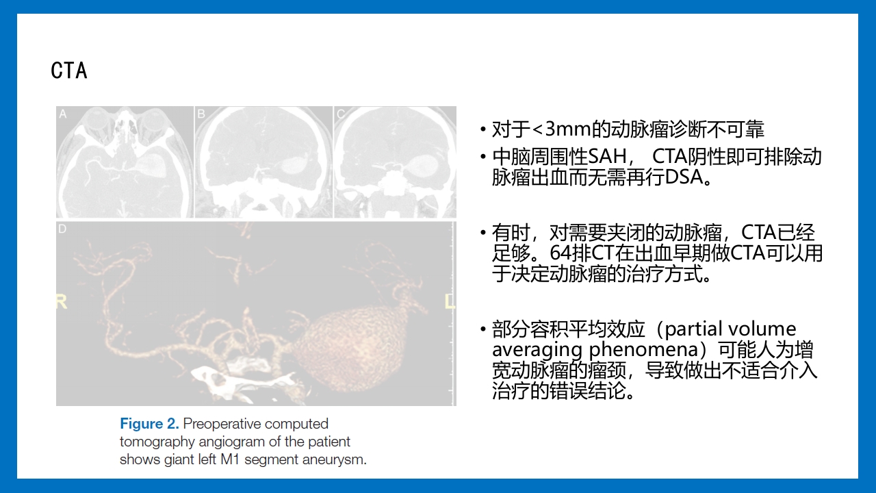 蛛网膜下腔出血的诊断和处理PPT课件30