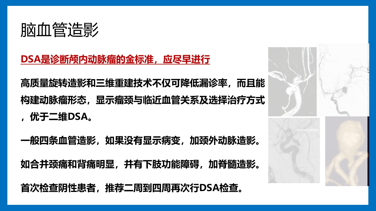 蛛网膜下腔出血的诊断和处理PPT课件37