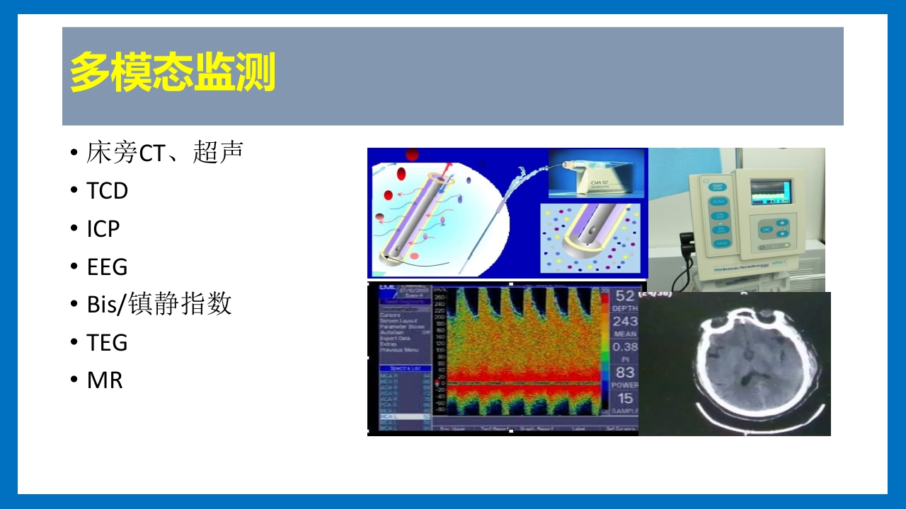 蛛网膜下腔出血的诊断和处理PPT课件56
