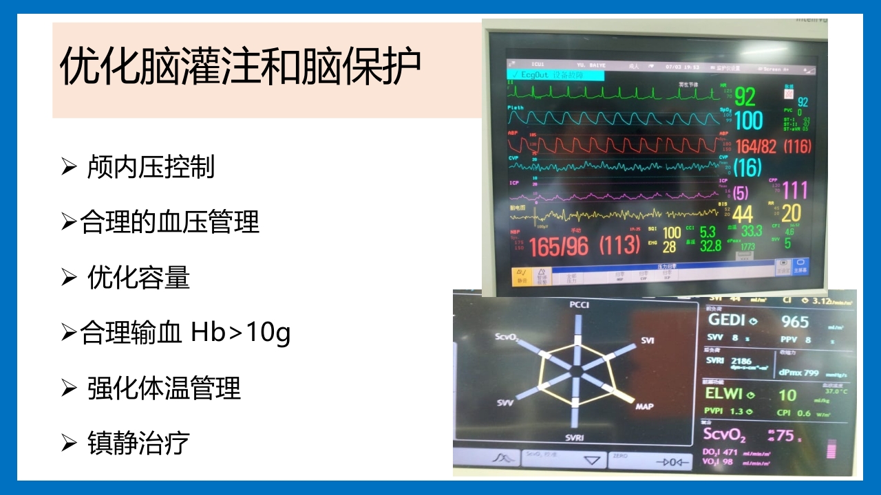 蛛网膜下腔出血的诊断和处理PPT课件59