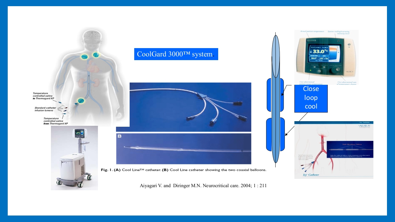 蛛网膜下腔出血的诊断和处理PPT课件62