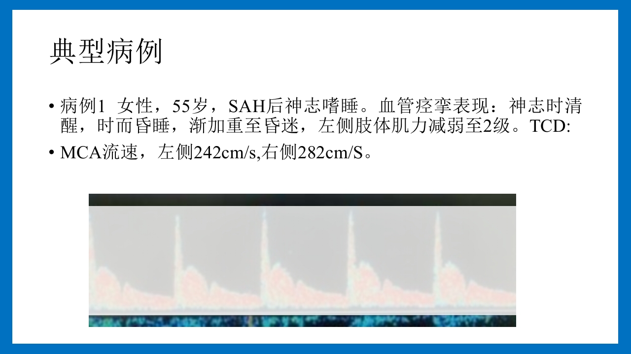 蛛网膜下腔出血的诊断和处理PPT课件71