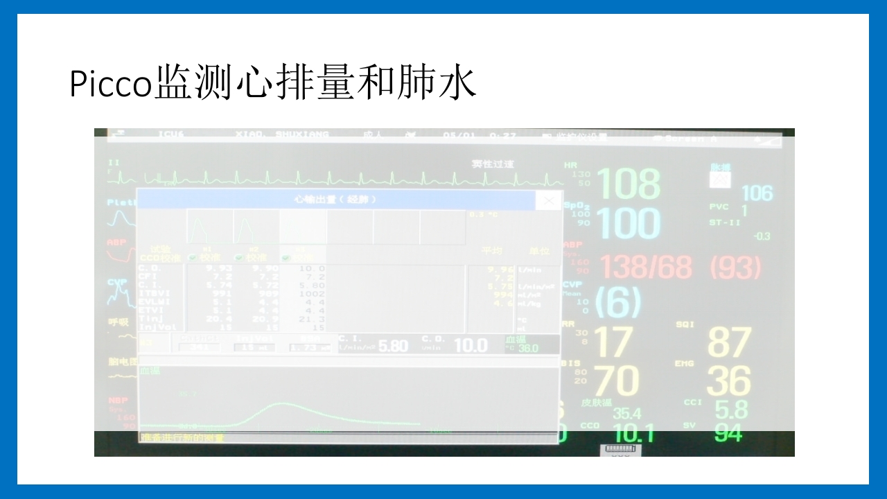 蛛网膜下腔出血的诊断和处理PPT课件77