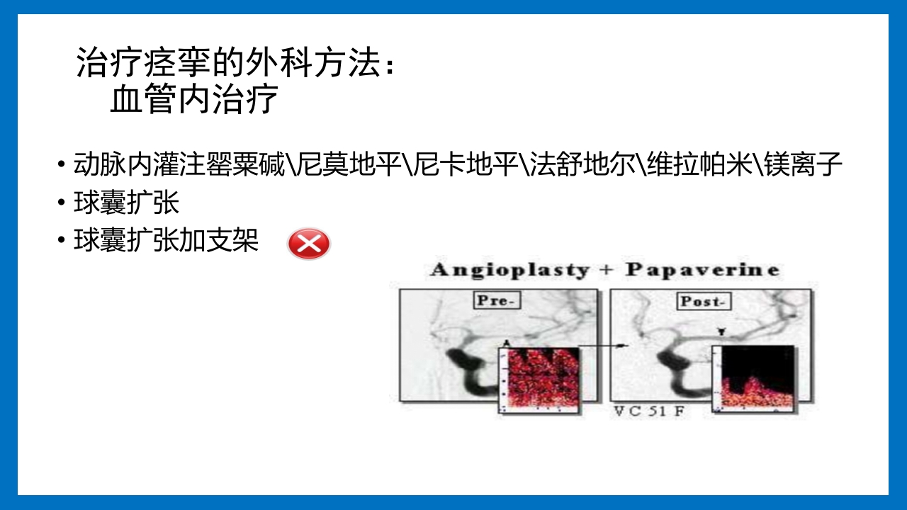 蛛网膜下腔出血的诊断和处理PPT课件78