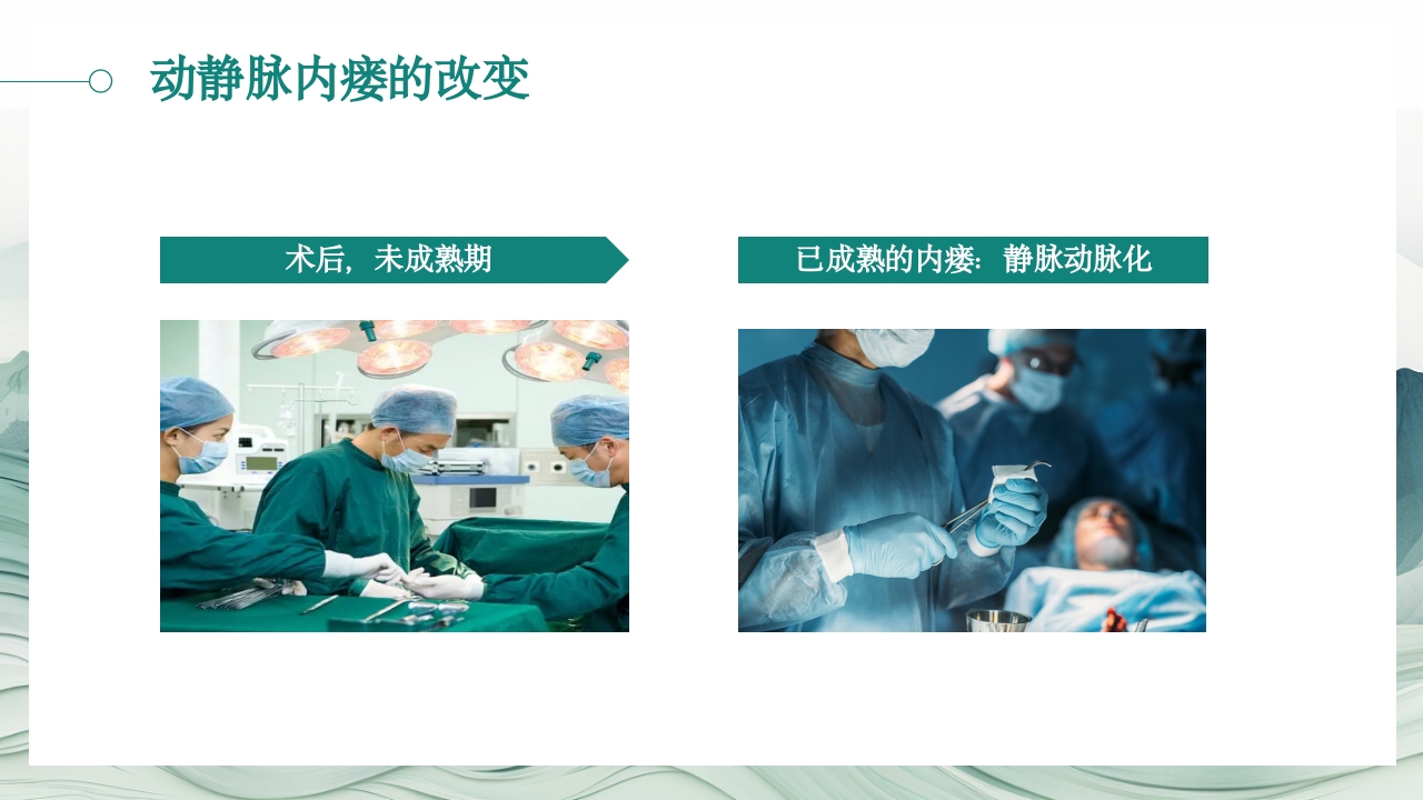 动静脉内瘘的护理PPT课件5