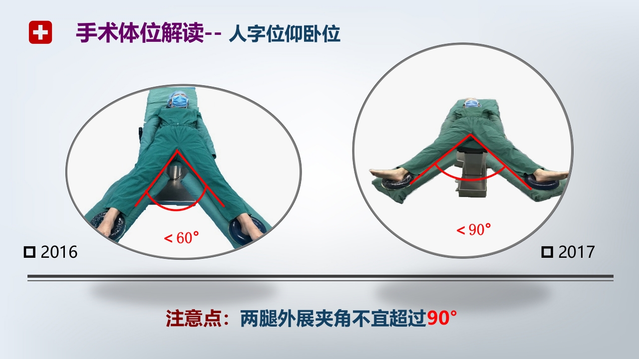 手术体位PPT课件12