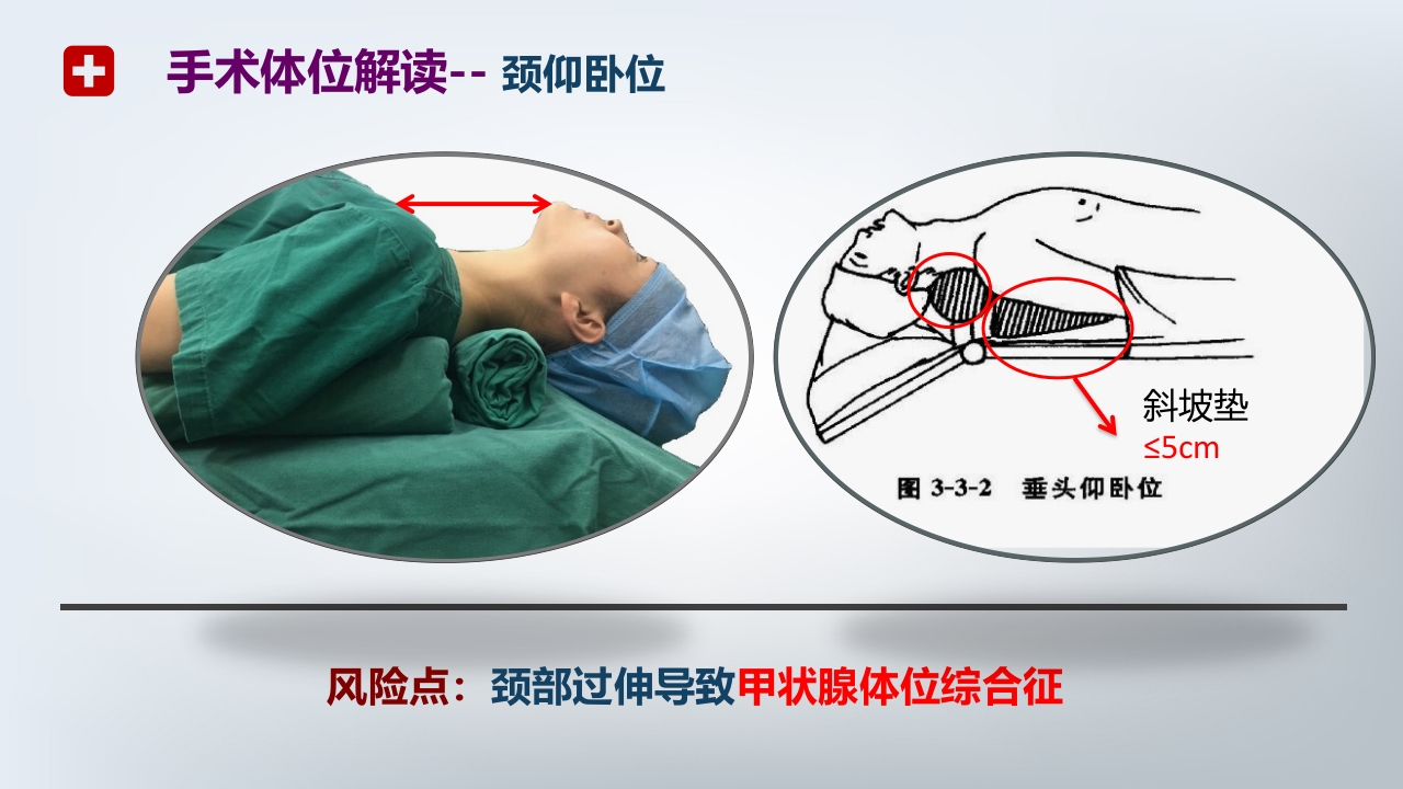 手术体位PPT课件13