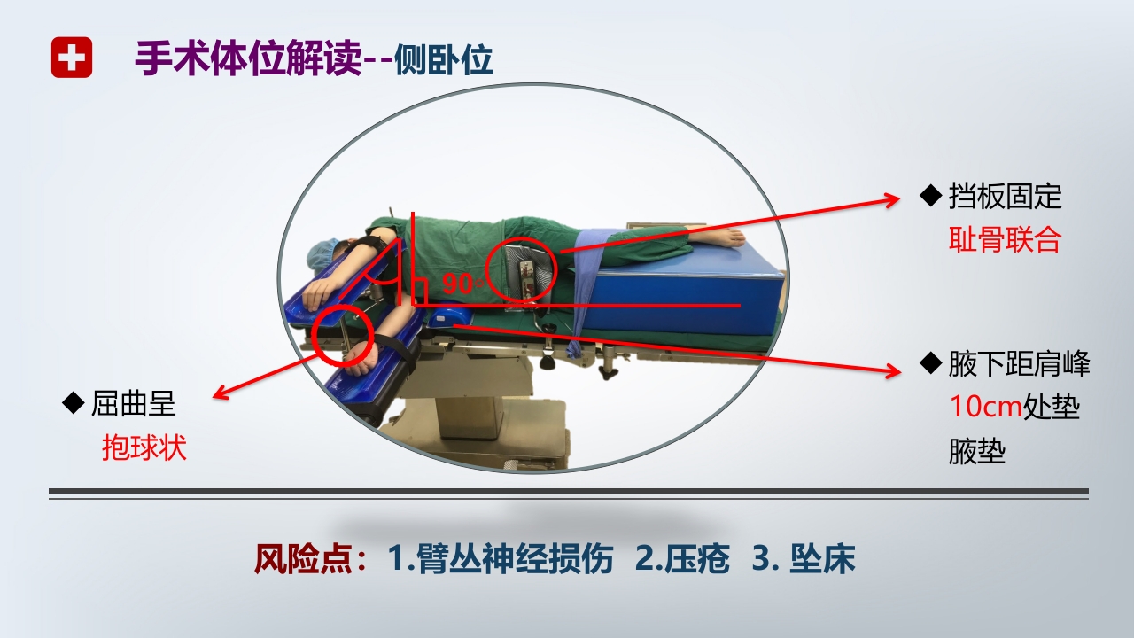 手术体位PPT课件14