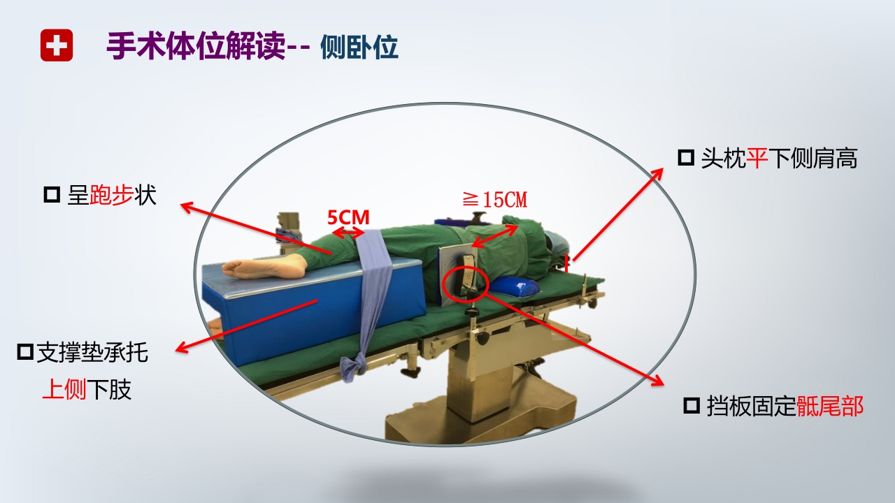 手术体位PPT课件15