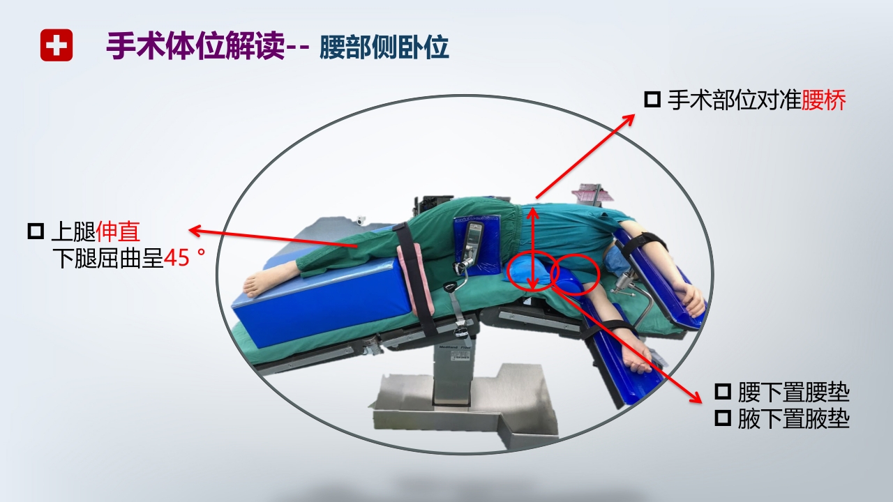 手术体位PPT课件16