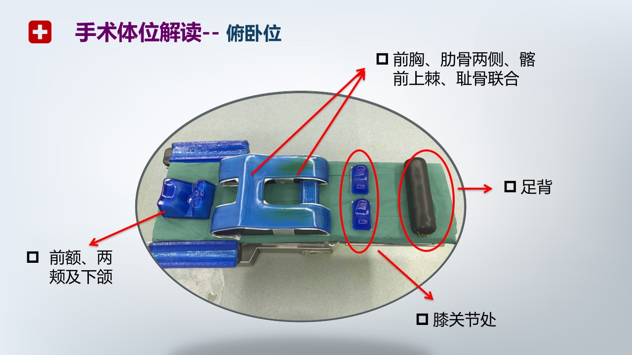 手术体位PPT课件18
