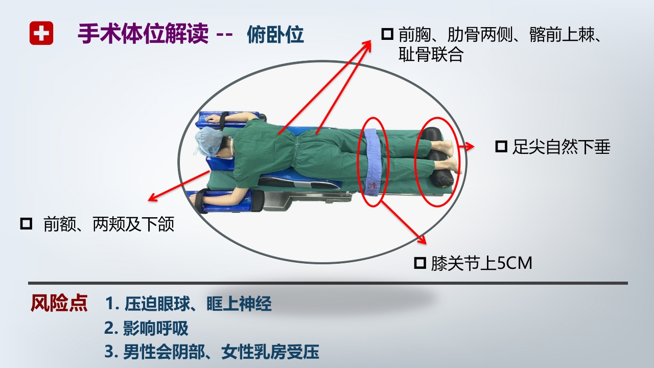 手术体位PPT课件19