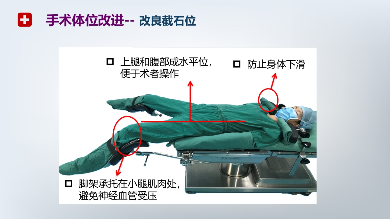 手术体位PPT课件24