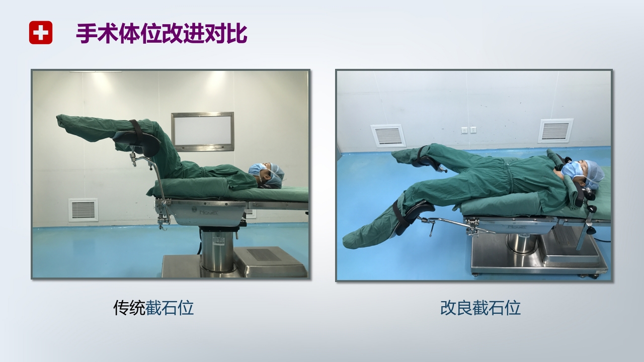 手术体位PPT课件25