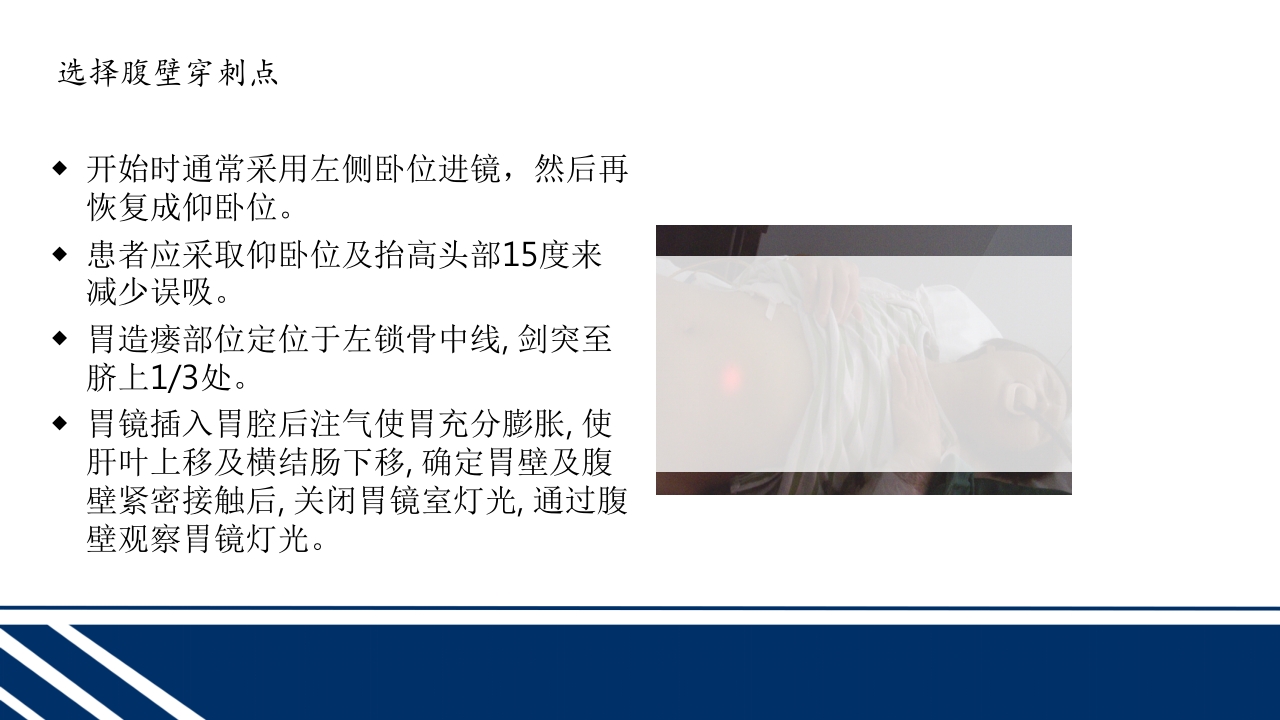 经皮内窥镜下胃空肠造瘘(PEGPEJ)的护理PPT课件14