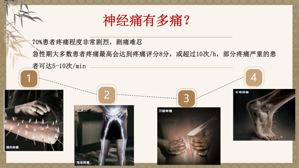 一例蛇串疮(带状疱疹)患者疼痛的个案护理PPT课件14