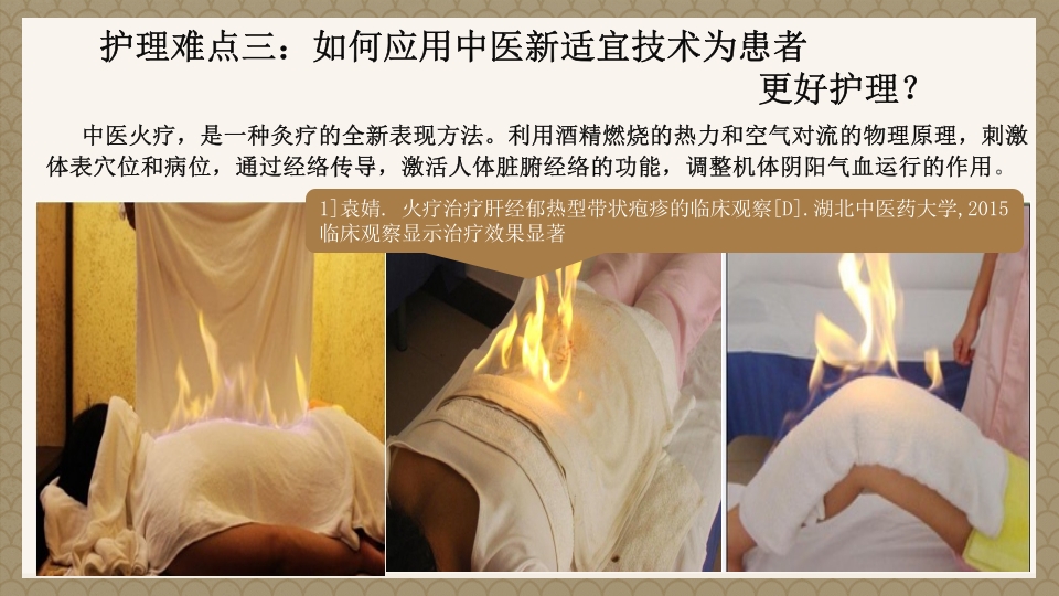 一例蛇串疮(带状疱疹)患者疼痛的个案护理PPT课件23