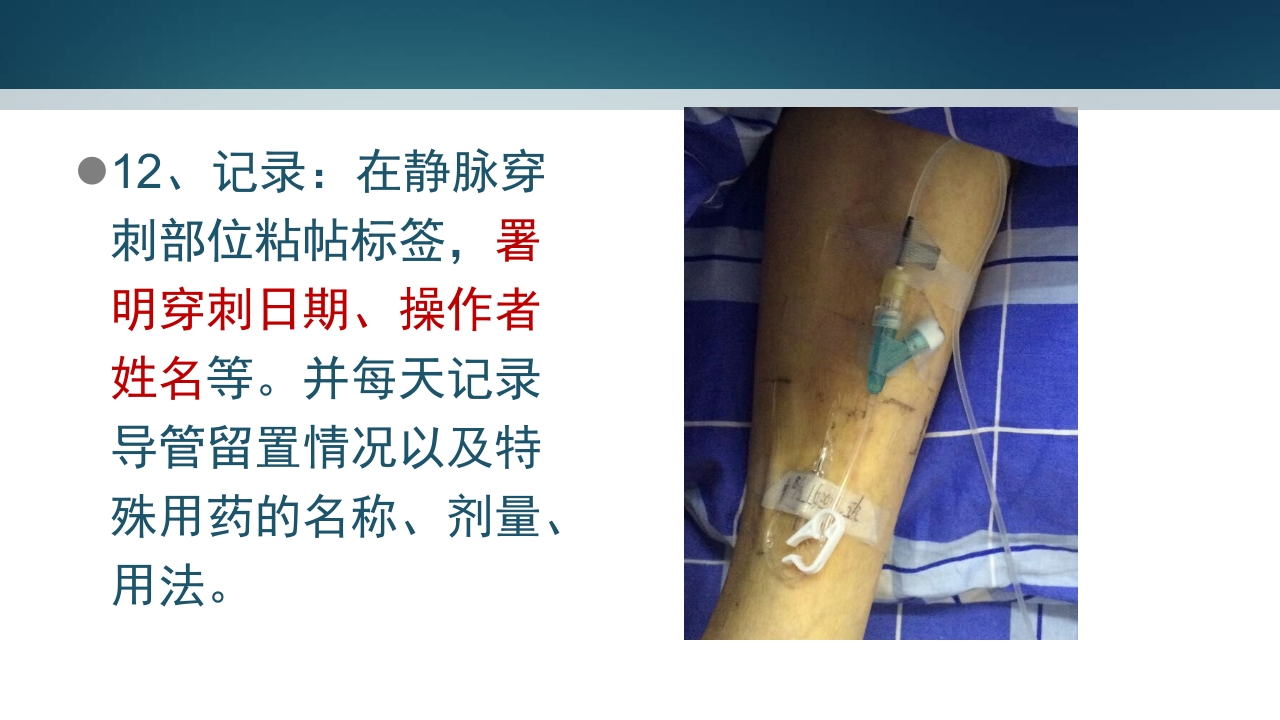 静脉留置针PPT课件12