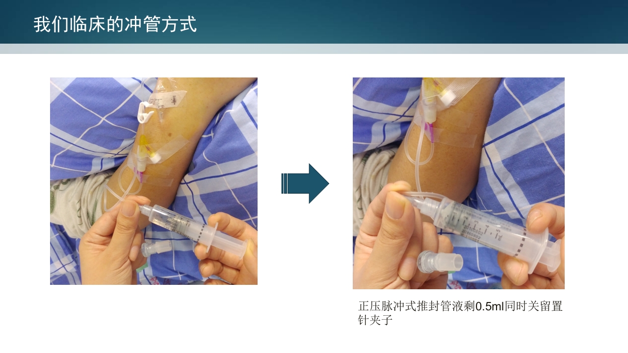 静脉留置针PPT课件17