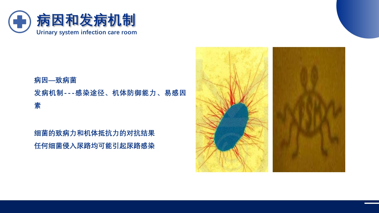 泌尿系统感染护理查房PPT课件8