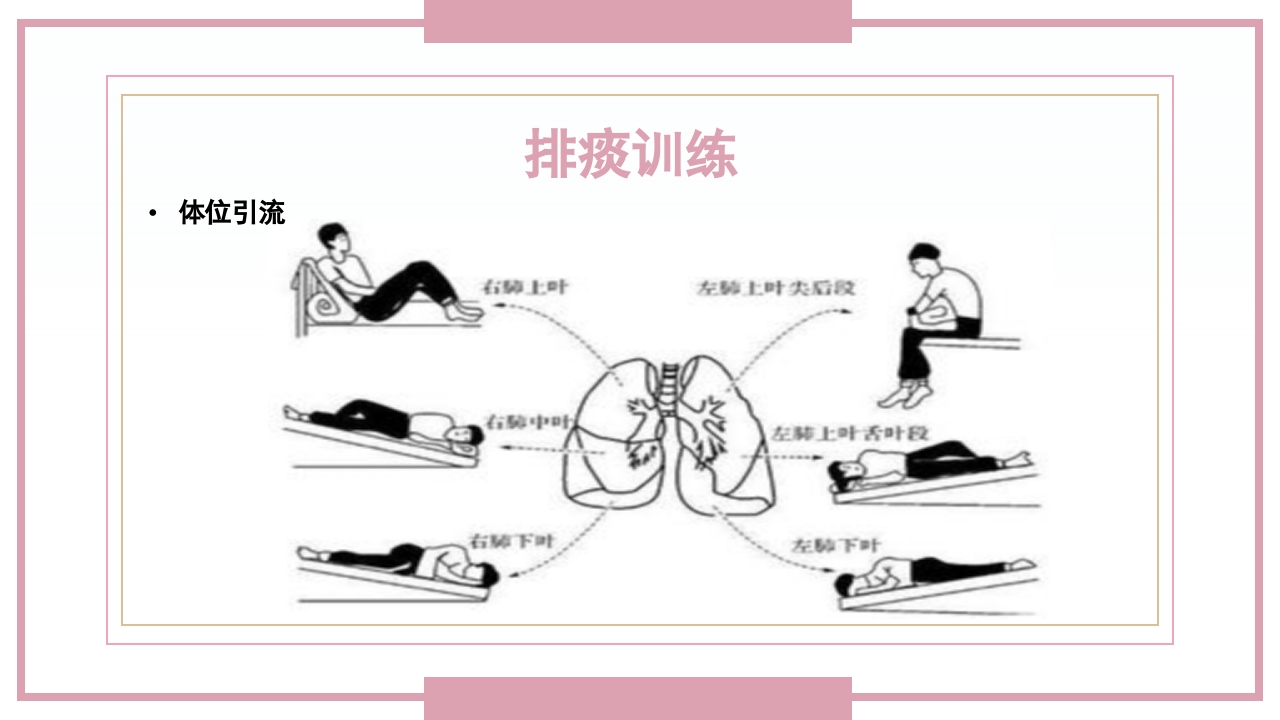 肋骨骨折病人的护理PPT课件28