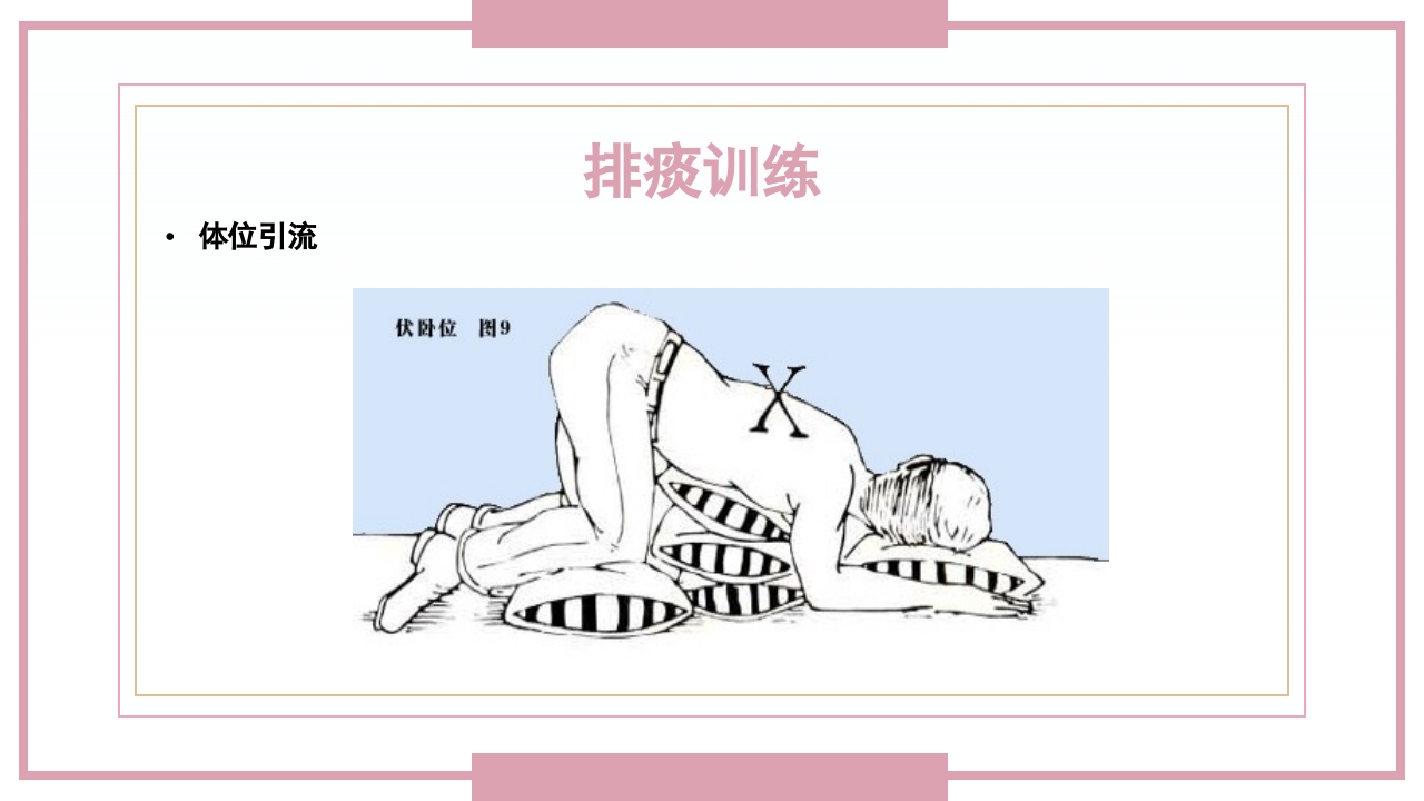 肋骨骨折病人的护理PPT课件29