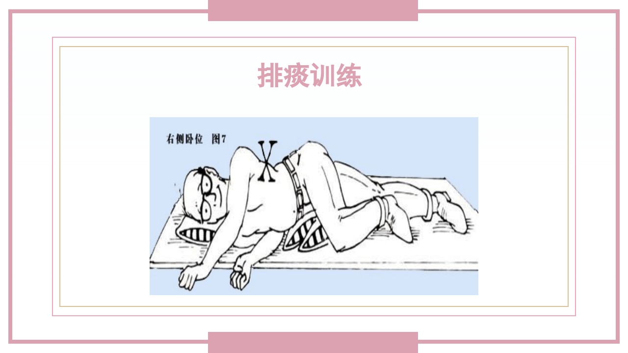 肋骨骨折病人的护理PPT课件31